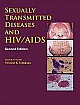 Sexually Transmitted Diseases and Aids