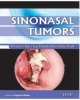 Sinonasal Tumors  2012