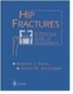 Hip Fractures: A Practical Guide to Management