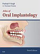 Atlas of Oral Implantology, 3e