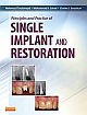 Principles and Practice of Single Implant and Restorations, 1e