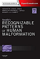 Smith`s Recognizable Patterns of Human Malformation: Expert Consult - Online and Print, 7e