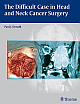 The Difficult Case in Head and Neck Cancer Surgery