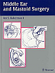 Middle Ear and Mastoid Surgery 