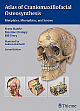 Atlas of Craniomaxillofacial Osteosynthesis: Microplates, Miniplates and Screws 2nd Edition 