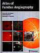 Atlas of Fundus Angiography