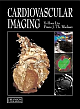 Cardiovascular Imagings 