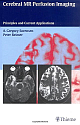 Cerebral MR Perfusion Imaging: Principles and Current Applications