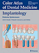 Implantology (Color Atlas of Dental Medicine) 