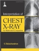 INTERPRETATION OF CHEST X-RAY AN ILLUSTRATED COMPANION