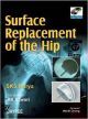 Surface Replacement of the Hip (with DVD Rom) 