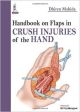 Handbook on Flaps in Crush Injuries of the Hand