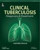 Clinical Tuberculosis: Diagnosis and Treatment 