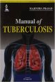 Manual Of Tuberculosis