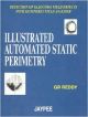 Illustrated Automated Static Perimetry