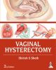 Vaginal Hysterectomy 