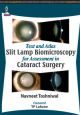 Text and Atlas—Slit Lamp Biomicroscopy for Assessment in Cataract Surgery 