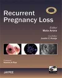 Recurrent Loss in Pregnancy, 2/e with cd