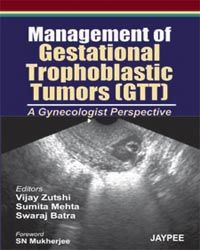 Management of Gestational Trophoblastic Tumorsn (GTT)