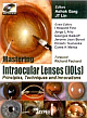 Mastering (r) Intraocular Lenses (iols) : Pric. , Tech. & Innovations(with Dvd Rom)