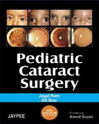 Pediatric Cataract Surgery 1/e, 2007 with DVD