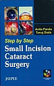 	 Step by Step Small incision Cataract Surgery with 2 CD-ROMs 1st Edition 