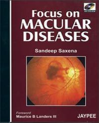 Focus on Macular diseases DVD-rom