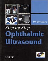 Step by Step Ophthalmic Ultrasound, 2007 with CD