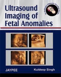 Ultrasound Imaging of Fetal Anomalies,2007