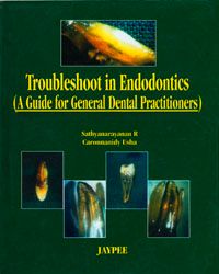 Troubleshoot in Endodontics: A Guide for Gen. Dental Prac.