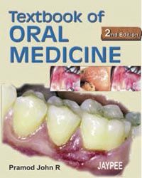 Textbook of Oral Medicine