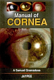 Manual of Cornea 1st Edition 