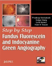 Step by Step Fundus Fluorescein and Indocyanine Green Angiography with cd, 1/e