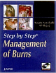 Step by Step Management of Burns with Photo cd-rom