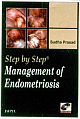 STEP BY STEP MANAGEMENT OF ENDOMETRIOSIS WITH DVD-ROM,2008