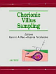 CHORIONIC VILLUS SAMPLING