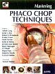 Mastering (r) Phaco Chop Techniques With Dvd- Rom 