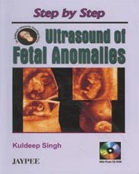 Step by Step Ultra.  Fetal Anomalies with CDROM