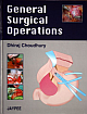  General Surgical Operations 1st Edition